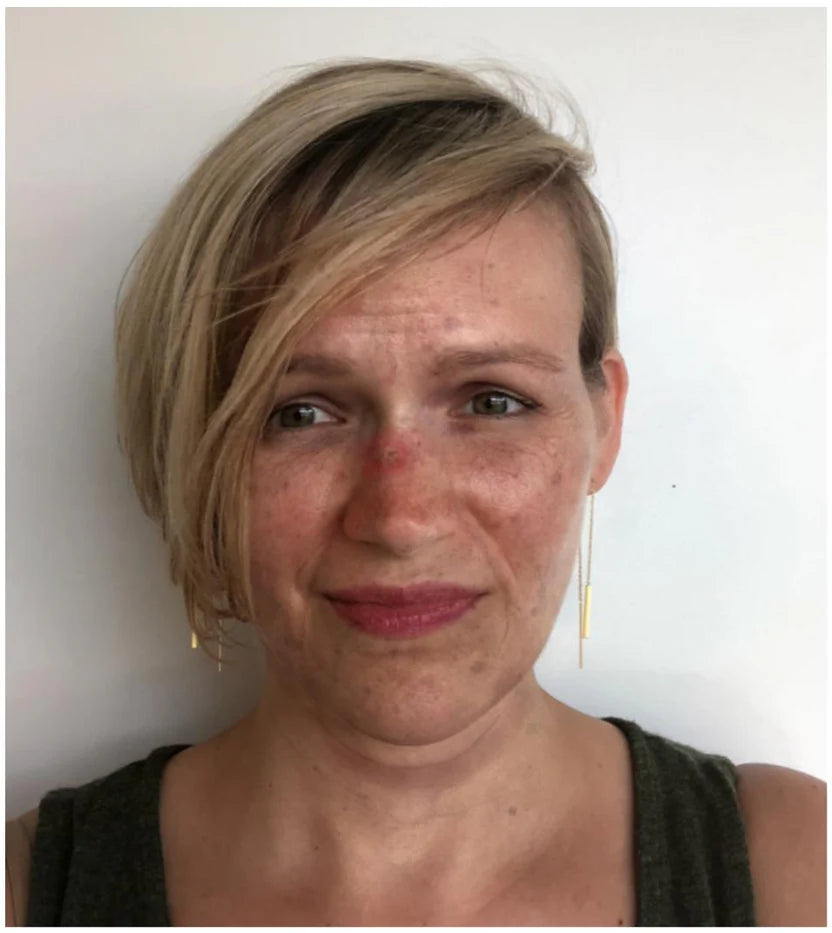 Bloobeac® Blemish Removing Beauty Cream image Bloobeac® Blemish Removing Beauty Cream