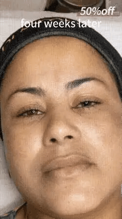 Bloobeac® Blemish Removing Beauty Cream image Bloobeac® Blemish Removing Beauty Cream